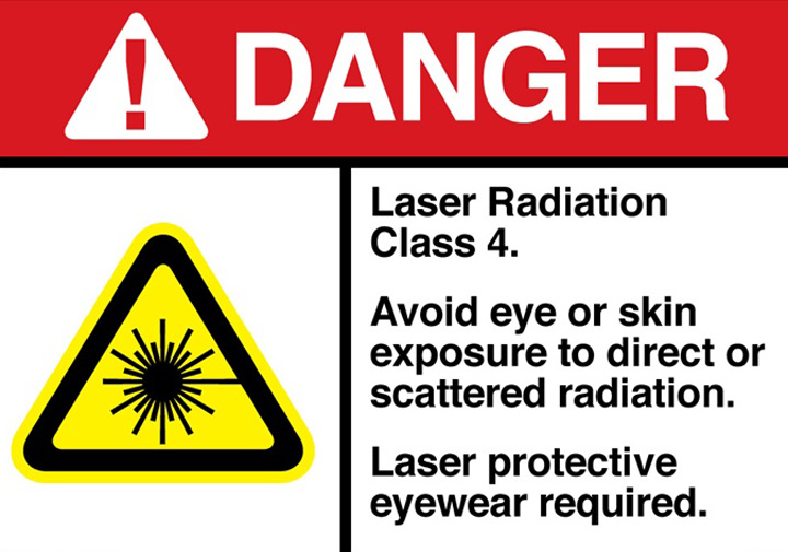 sicurezza laser